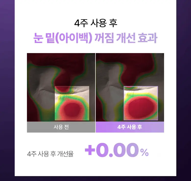 [NEW|아이백리프팅] 바이오힐보 프로바이오덤 콜라겐 PDRN 아이백 & 미간 패치 6,800샷 상세페이지 15